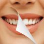 Импланты зубов - за и против их установки