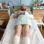Дружина Захисника Андрія Гнатенка звертається по допомогу: потрібна реабілітація після ампутації ступнів ніг