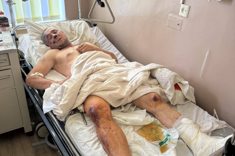 Дружина постраждалого під час вибуху в Березині просить допомогу на лікування чоловіка