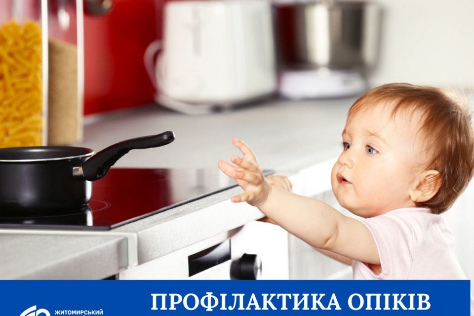 Профілактика опіків у дітей
