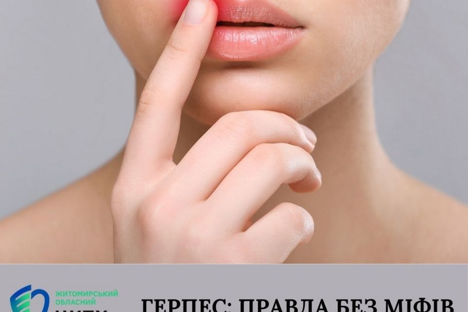 Герпес: правда без міфів