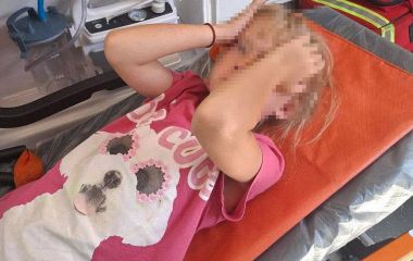 У Житомирі чоловік на електросамокаті збив 7-річну дівчинку на тротуарі — дитину госпіталізовано