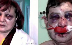 Переломи щелеп, розбиті носи та реанімація – результати бійки у тетерівському шинку