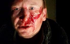 Піщані війни: на Житомирщині жорстоко розправилися над активістом