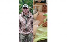 Потрібна допомога: відкрито збір коштів для Захисника з Коростишева, який втратив руку і ногу внаслідок обстрілу