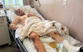Дружина постраждалого під час вибуху в Березині просить допомогу на лікування чоловіка