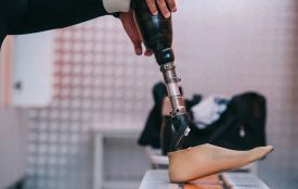 Уряд підвищив доступність протезів та ортезів для дітей з інвалідністю та цивільних постраждалих від війни