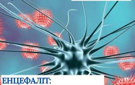 Енцефаліт: коли мозок потребує захисту
