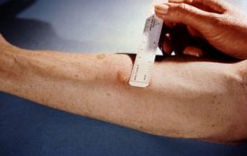 Все про пробу Манту: правда і міфи