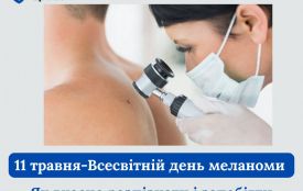 Всесвітній день меланоми: як вчасно розпізнати і запобігти небезпечному раку шкіри