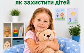 Вітряна віспа: як захистити дітей