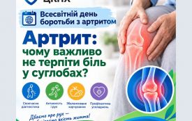 Артрит: чому важливо не терпіти біль у суглобах?
