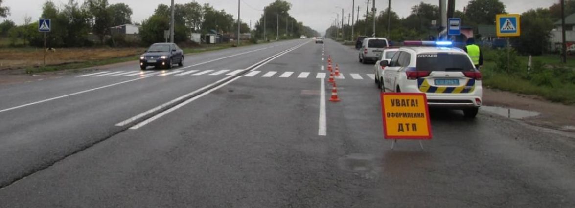 У Бердичівському районі на пішохідному переході автомобіль збив житомирянку