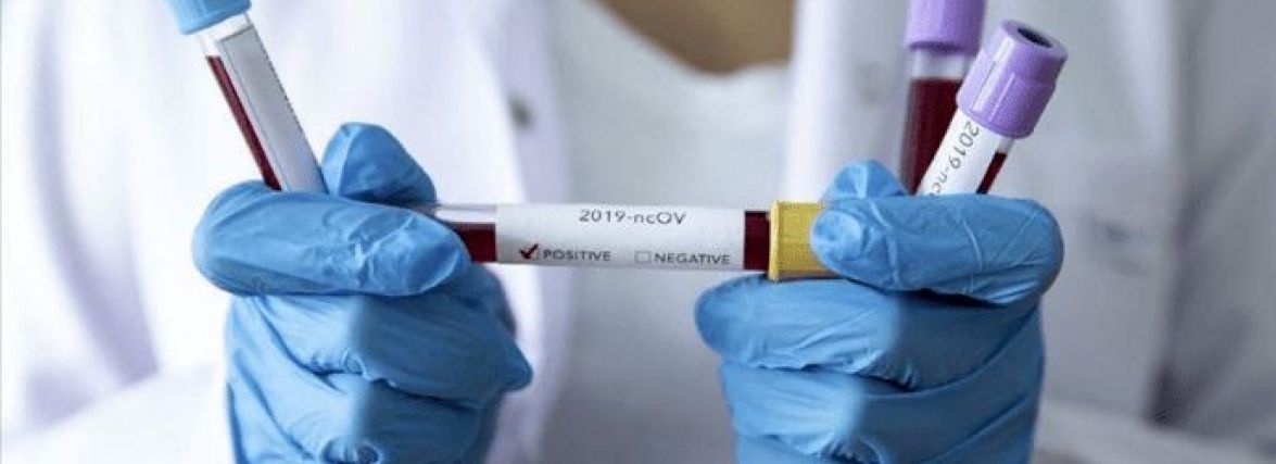 На Житомирщині станом на 28 вересня зареєстровано 80 нових підтверджених випадків COVID-19