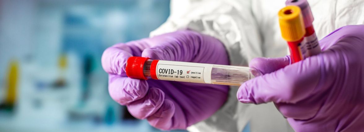 На Житомирщині за добу - 24 нові випадки COVID-19