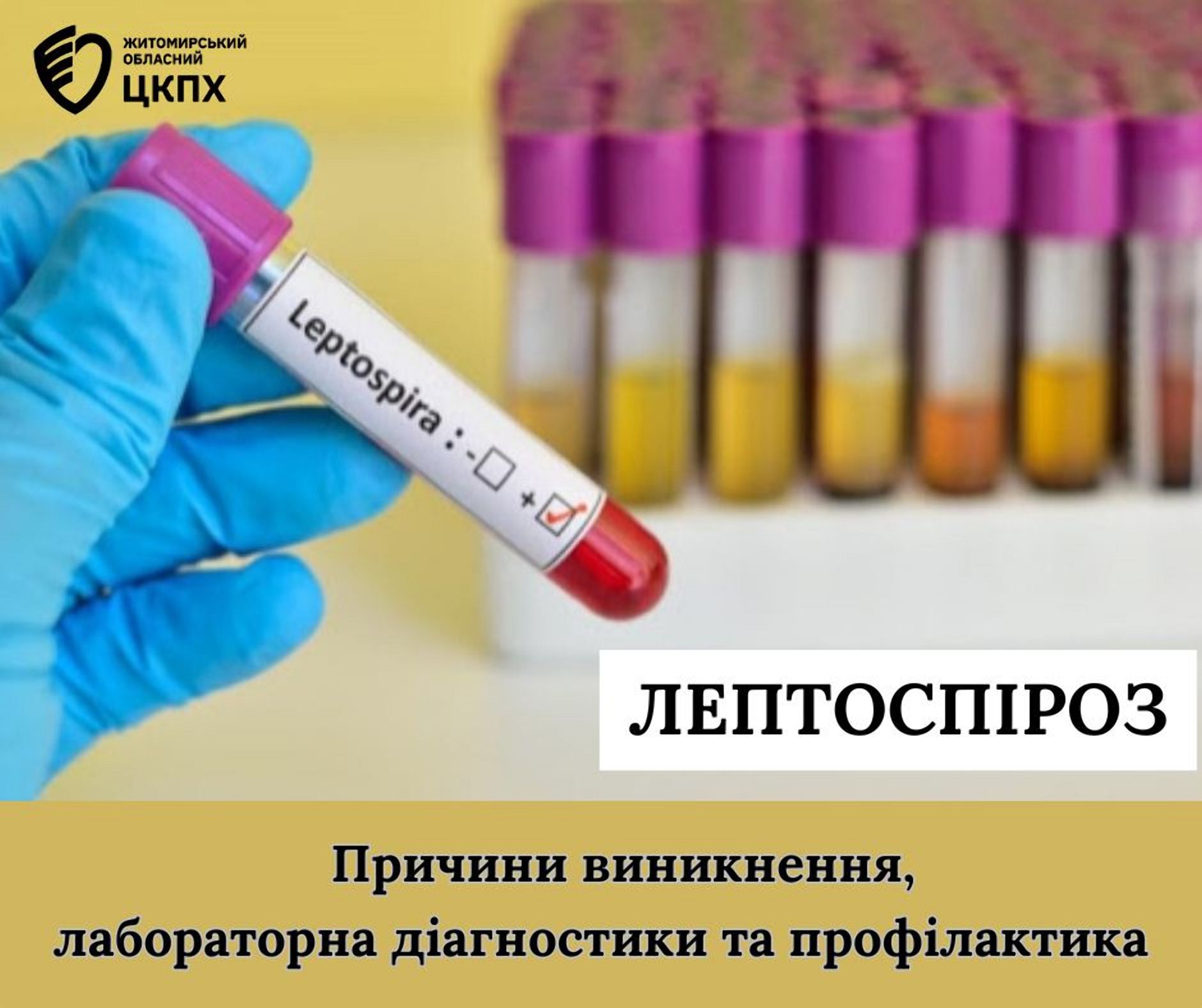 Лептоспіроз. Причини виникнення, результати лабораторної діагностики та профілактика