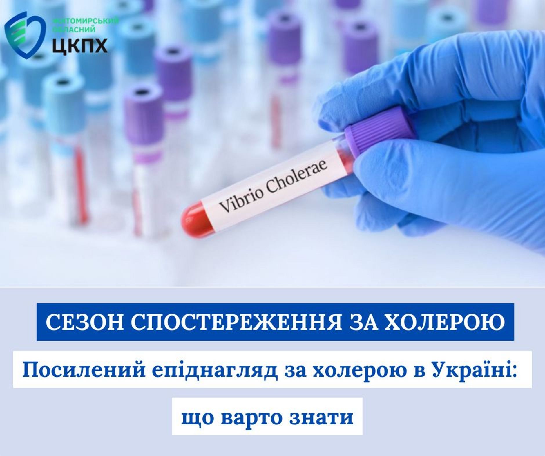 Посилений епіднагляд за холерою в Україні: що варто знати