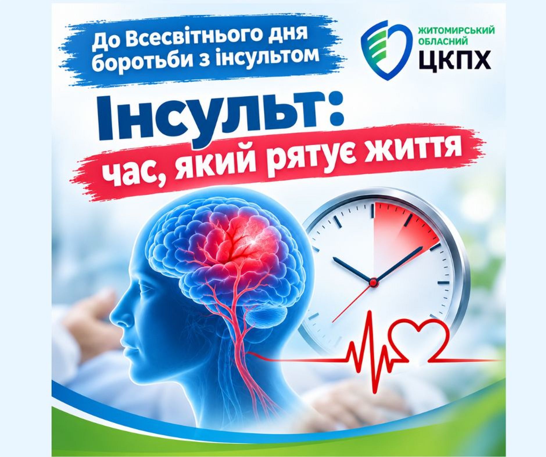 Інсульт: час, який рятує життя