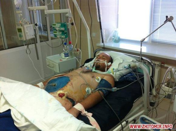 У пораненого Ігоря Лук’янця відкрилася кровотеча, потрібна термінова допомога на сайті 20minut.ua У пораненого Ігоря Лук’янця відкрилася кровотеча, потрібна термінова допомога, фото №1 на сайті 20minut.ua